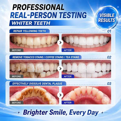 [BUY 1 GET 1 FREE] Niacinamide Charcoal Whitening Toothpaste