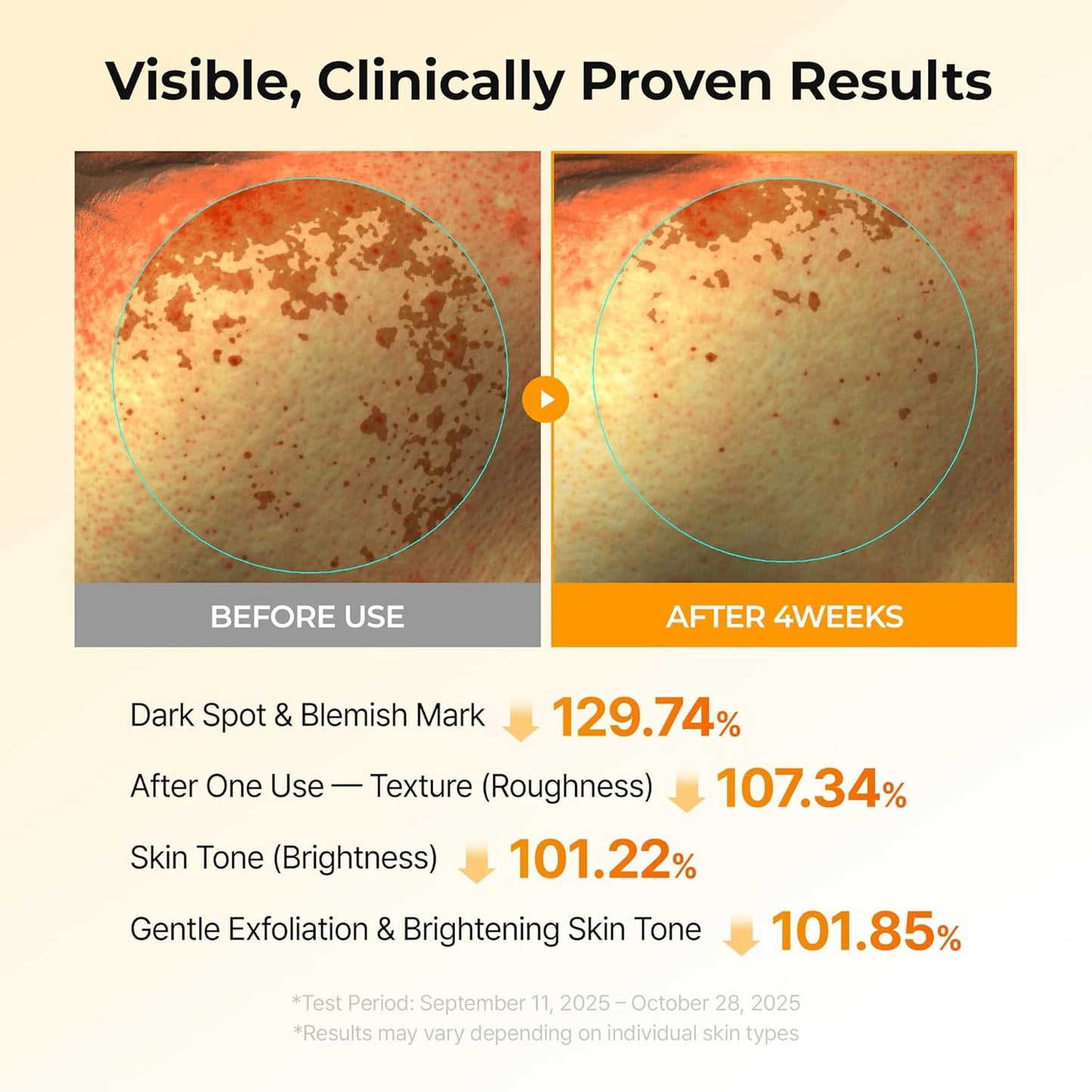 Advanced Dark Spot Corrector & Skin Brightening Toner Pads