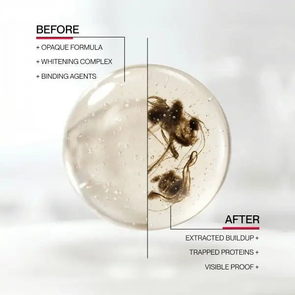 Brighten Your Smile Instantly with Advanced Whitening Mouthwash