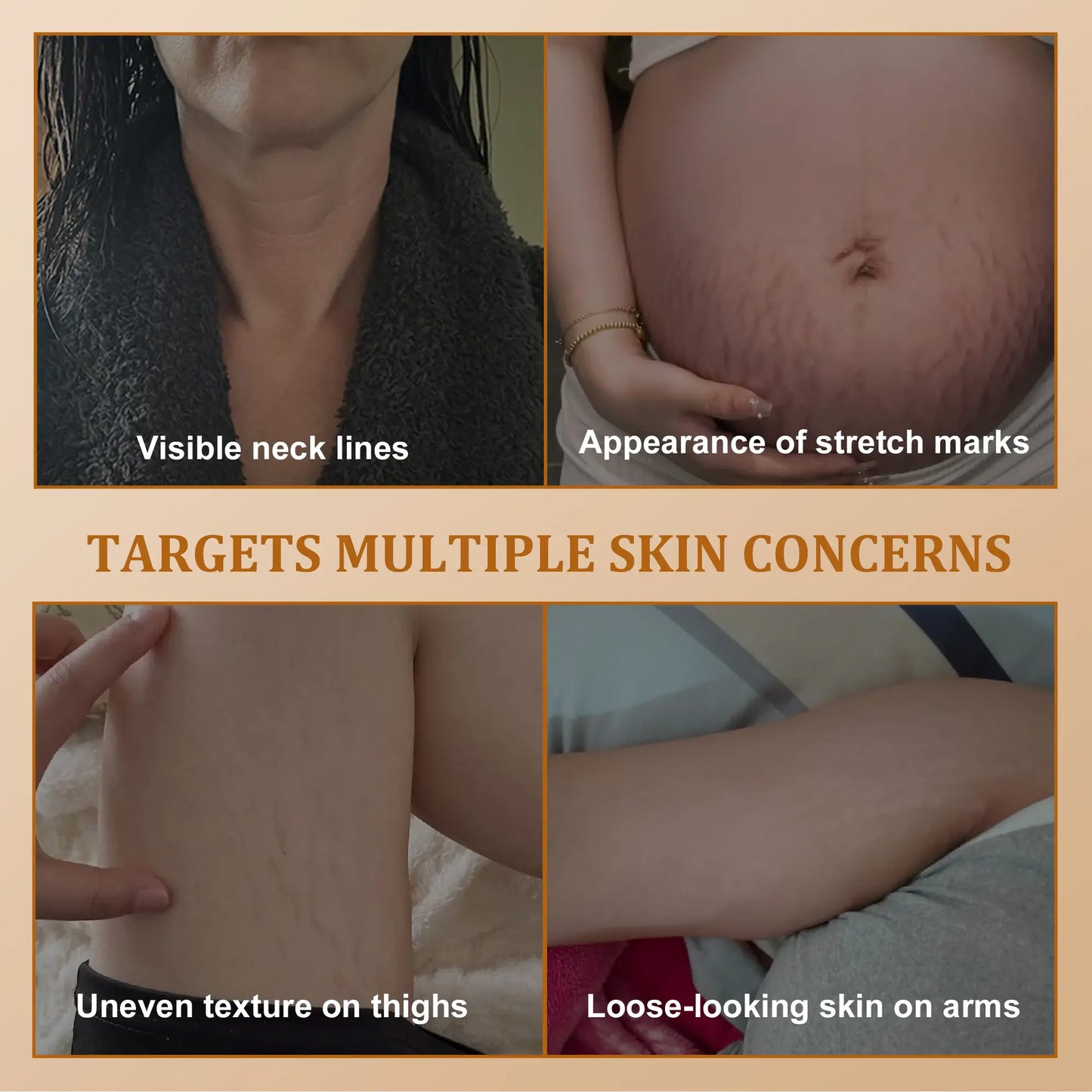 Erase Crepey Skin: Upgraded Hexapeptide Neck & Body Firming Cream