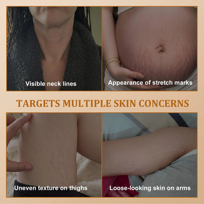 Erase Crepey Skin: Upgraded Hexapeptide Neck & Body Firming Cream