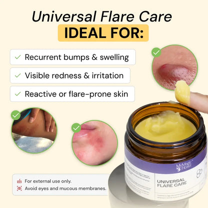 Universal Flare Care | Sudden & Recurring Skin Flare Ups