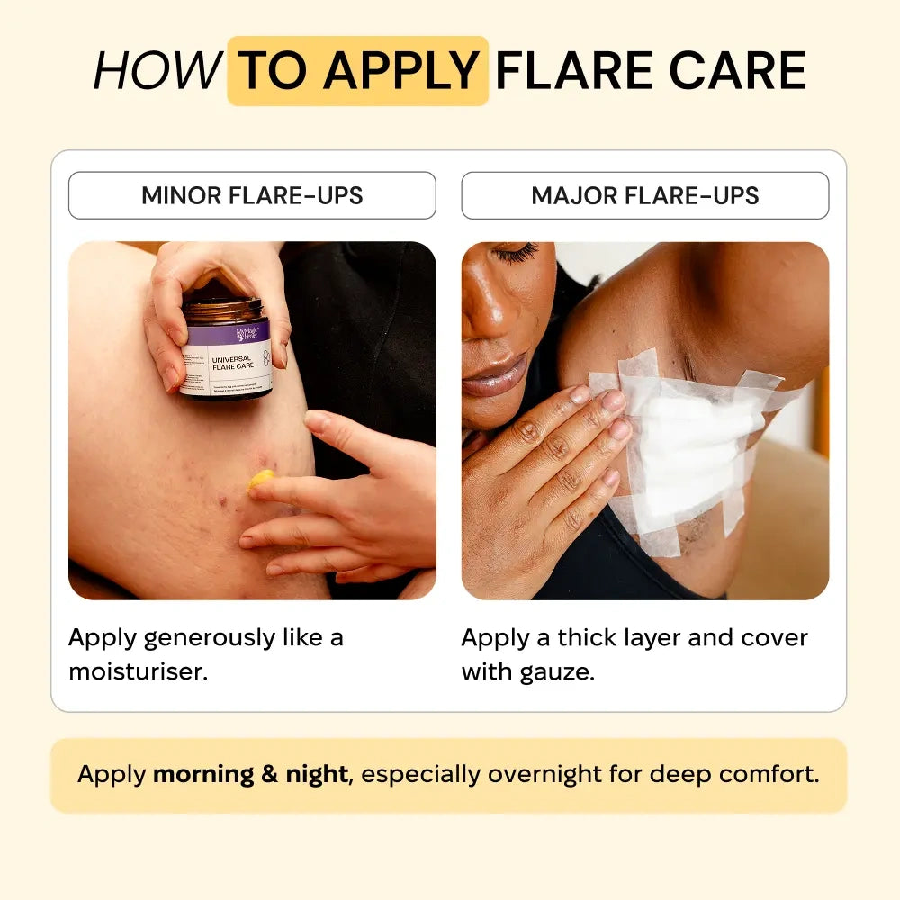 Universal Flare Care | Sudden & Recurring Skin Flare Ups