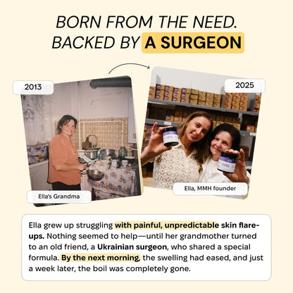 Universal Flare Care | Sudden & Recurring Skin Flare Ups