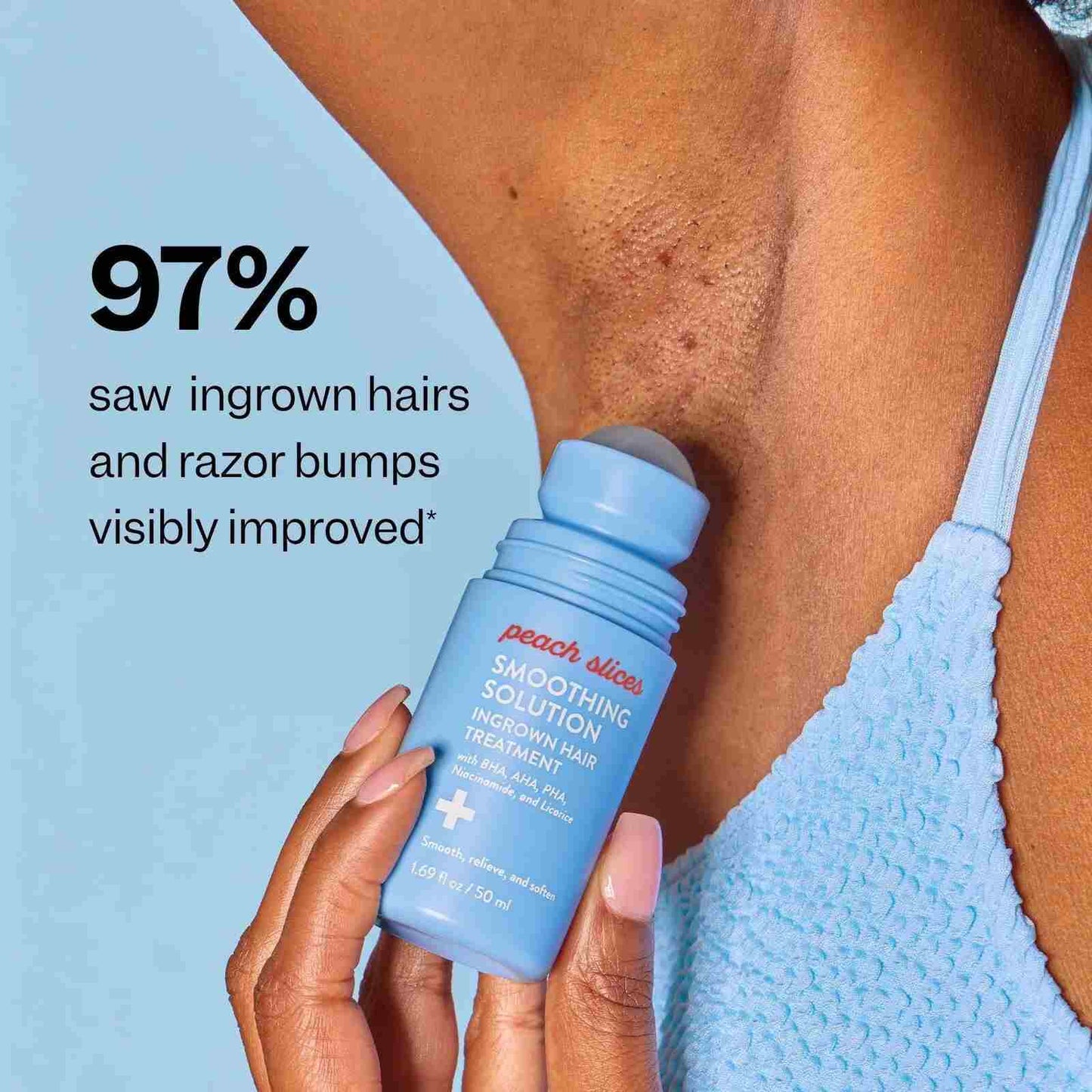 Flawless & Bump-Free Ingrown Hair Treatment Roll-On