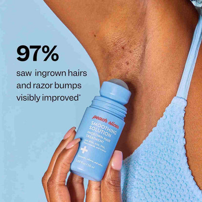 Flawless & Bump-Free Ingrown Hair Treatment Roll-On
