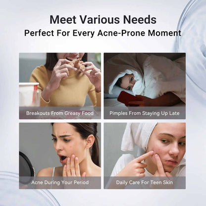 Rapid Acne Drying Lotion – Overnight Pimple & Body Treatment