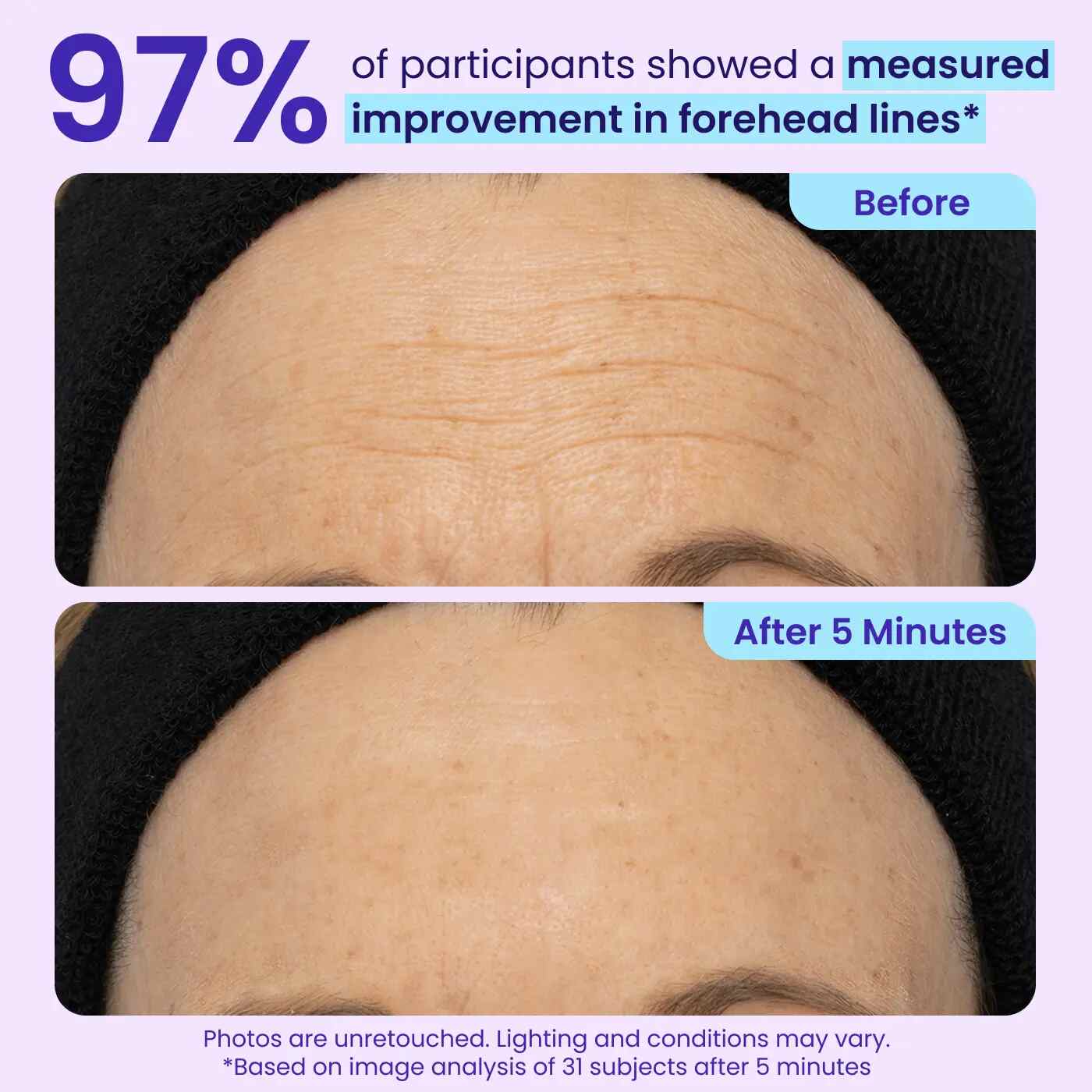 Instant Lift & Depuffing Eye Gel