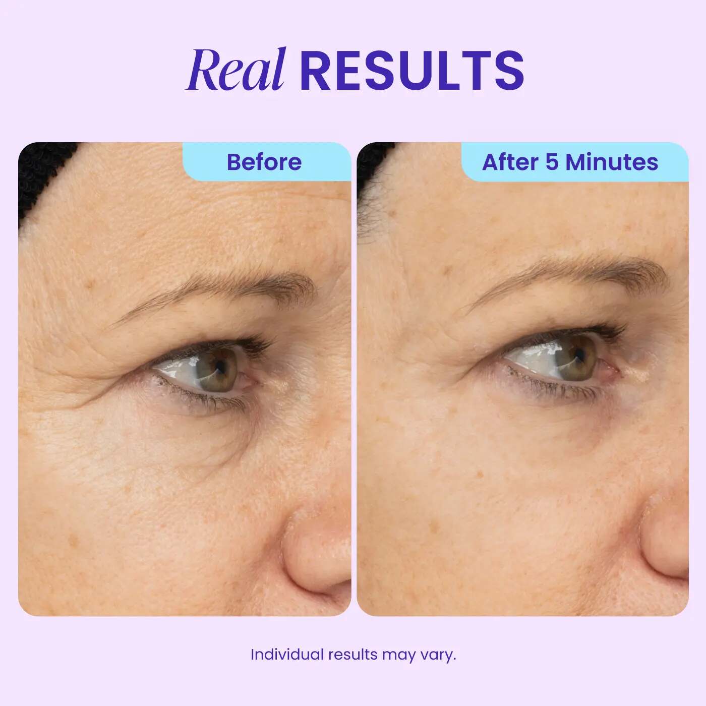 Instant Lift & Depuffing Eye Gel