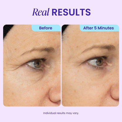 Instant Lift & Depuffing Eye Gel