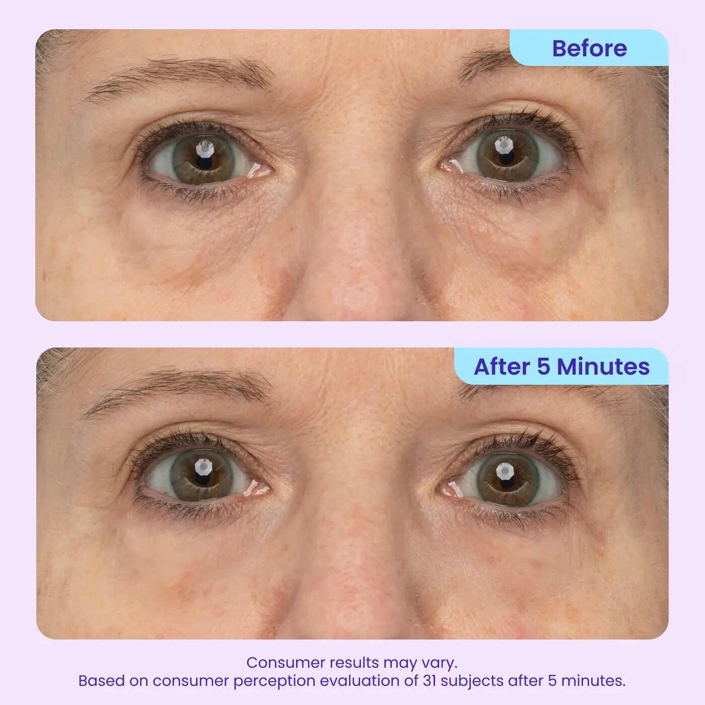 Instant Lift & Depuffing Eye Gel