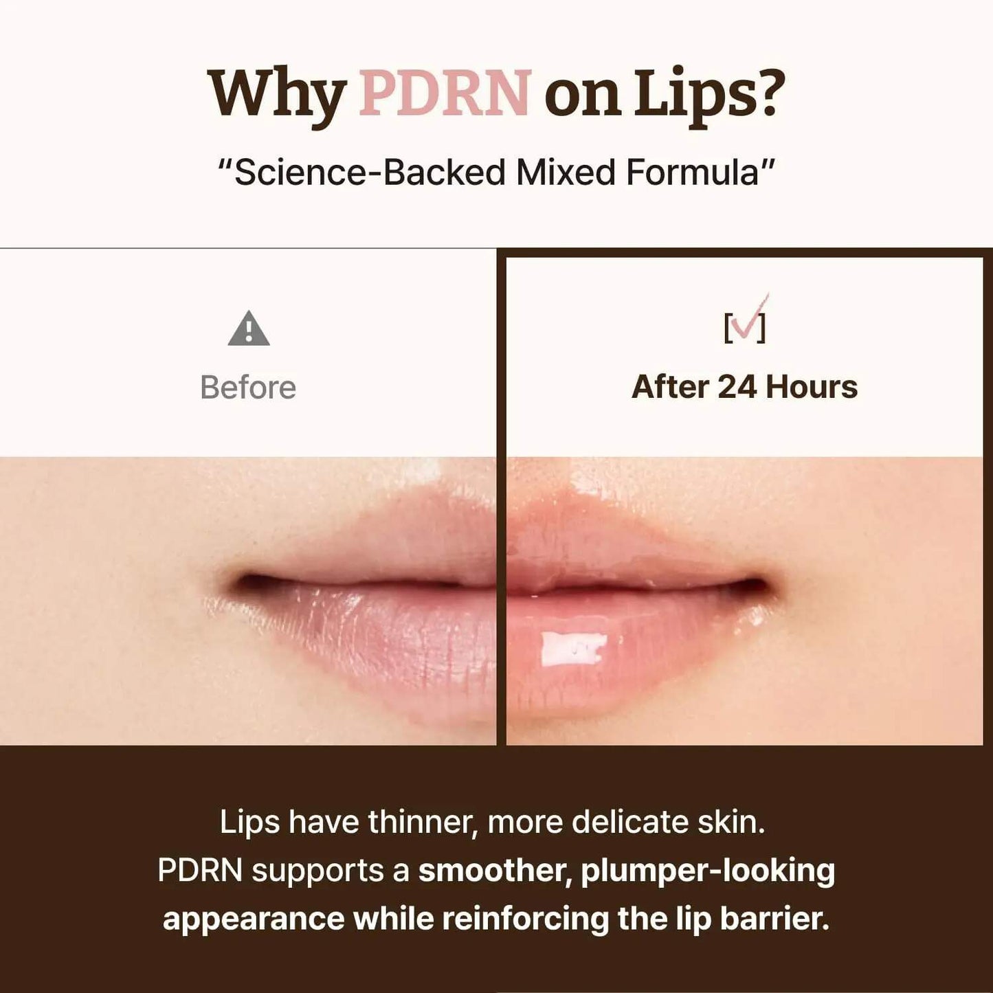 Advanced PDRN Hydrating Lip Rejuvenating Serum