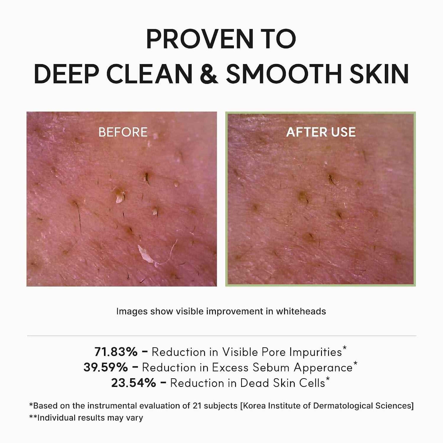 Green Rice Fresh Mochi Cleanser: Deep Pore Detox & Glass Skin Radiance