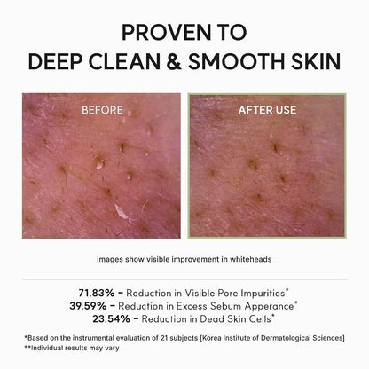 Green Rice Fresh Mochi Cleanser: Deep Pore Detox & Glass Skin Radiance