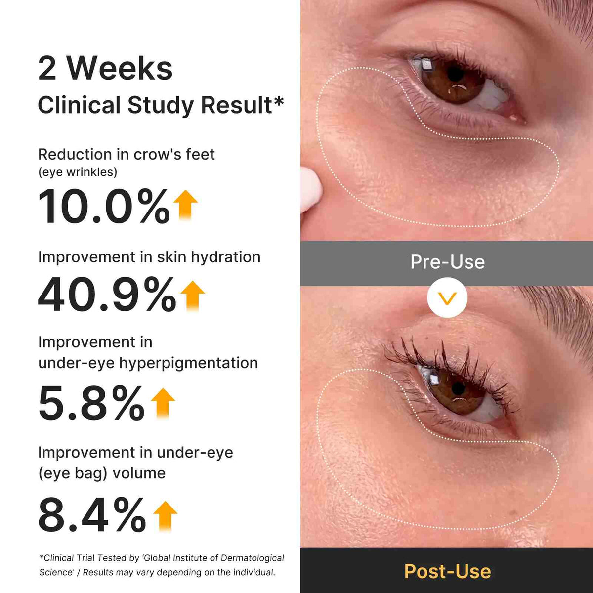 Kojic Turmeric Vitamin C Hydrogel Eye Patches