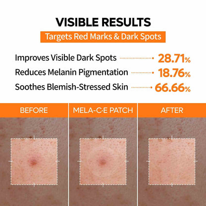 Blemish & Dark Spot Invisible Patch Duo