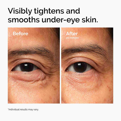 [BUY 2 GET 1 FREE] PDRN B9 Firming Eye Cream