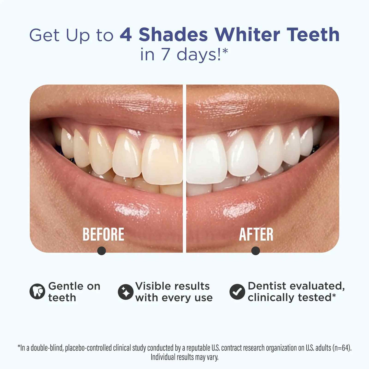 [BUY 1 GET 1 FREE] 7-Day Non-Slip Whitening Strips