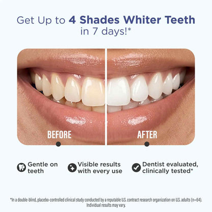 [BUY 1 GET 1 FREE] 7-Day Non-Slip Whitening Strips