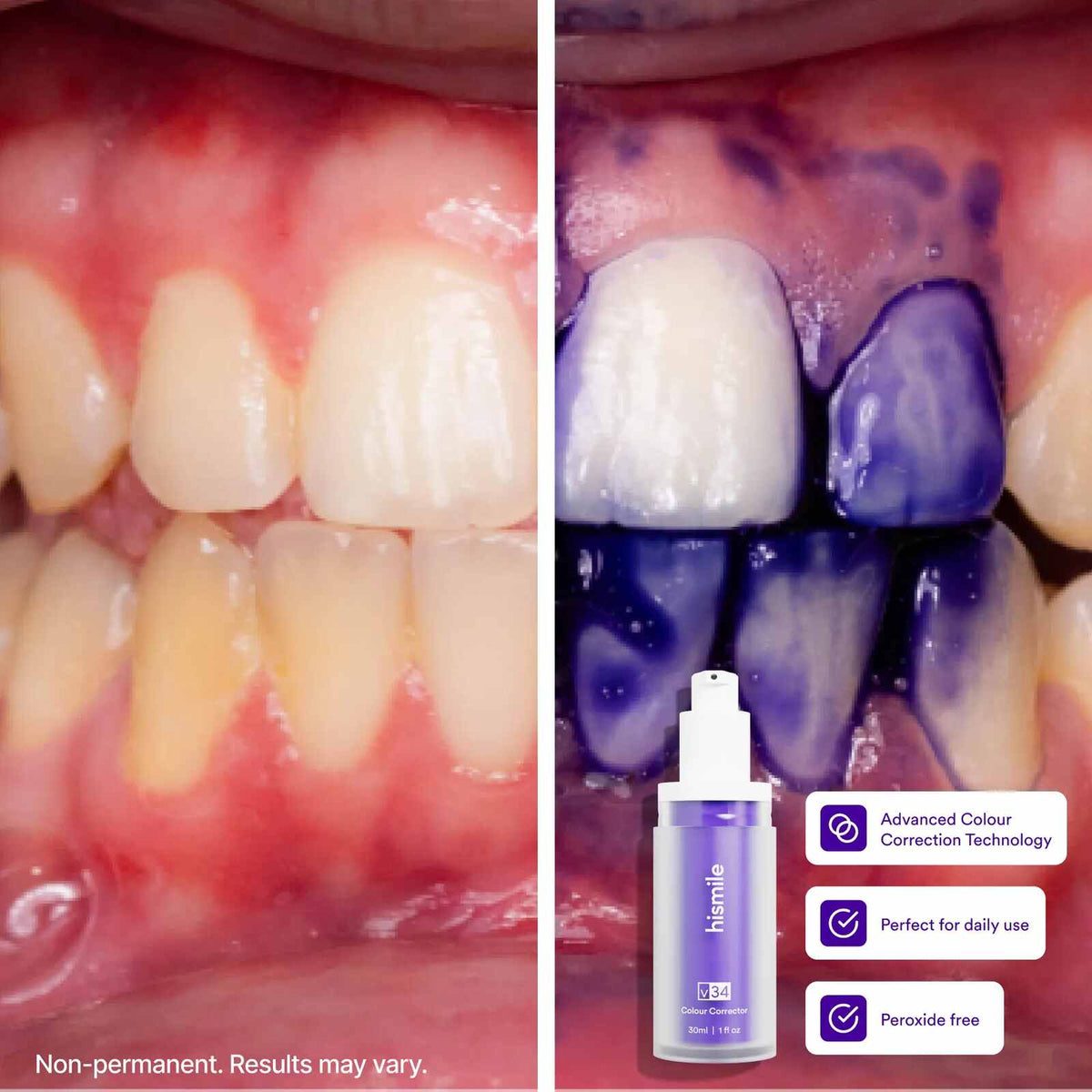 [BUY 1 GET 1 FREE] Purple Color-Correcting Whitening Toothpaste