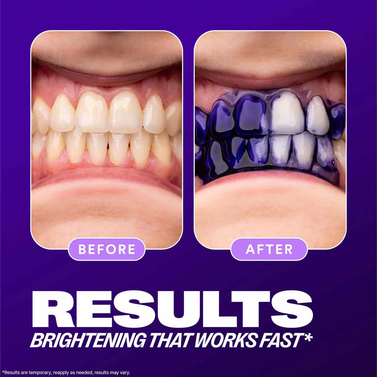 [BUY 1 GET 1 FREE] Purple Color-Correcting Whitening Toothpaste