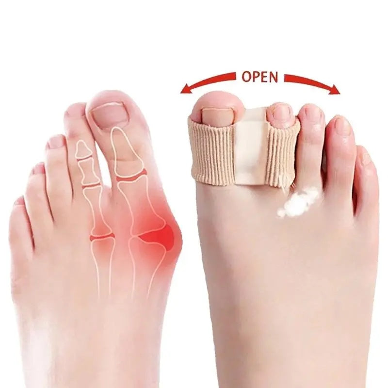 [BUY 1 GET 1 FREE] Silicone Toe Separators for Bunion Relief