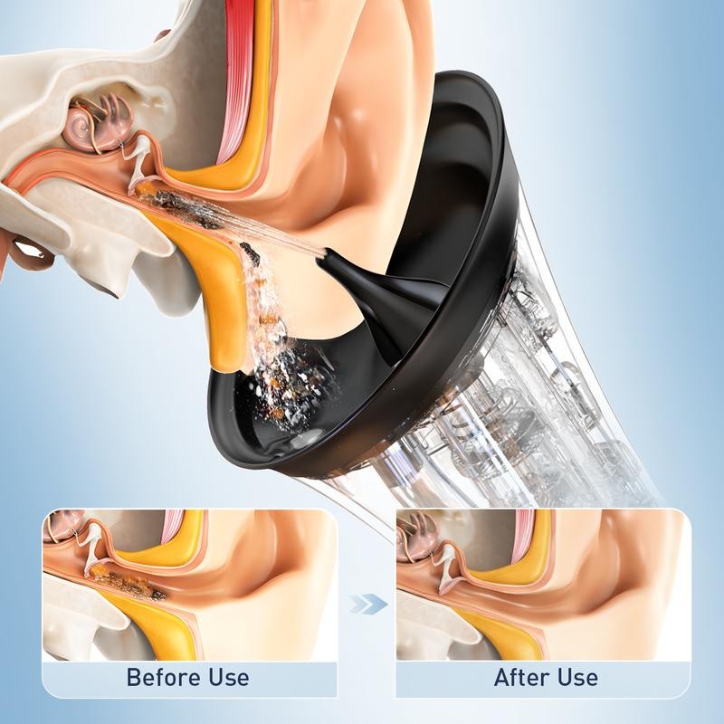 Water-Powered Electric Ear Wax Removal System