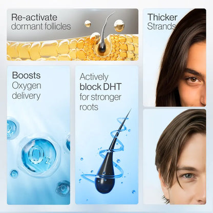 Advanced Hair Density Roll-On Serum 25 ml